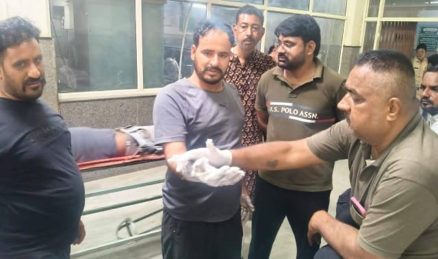 a6f738ff 9db6 4b81 baad e079890a17ce बीकानेर में पटाखों से 100 से अधिक झुलसे, तीन दिन में अधिक मामले Rajasthan News Portal बीकानेर अपडेट