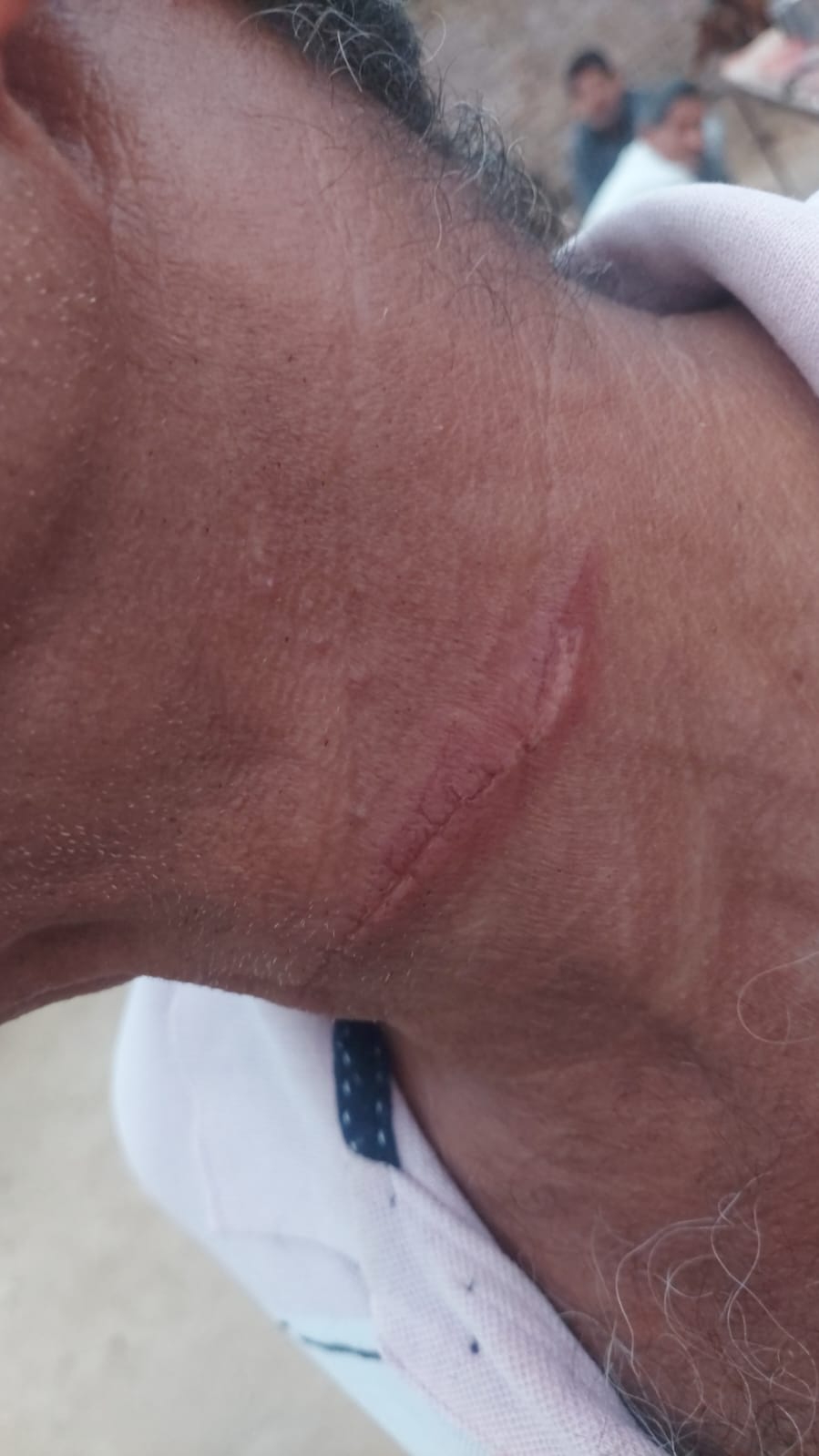 SAVE 20260314 200718 बीकानेर में चाइनीज मांझे का कहर Rajasthan News Portal राजस्थान