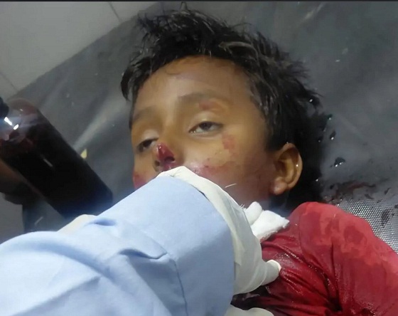 manja बीकानेर में चाइनीज मांझे से बच्चे की मौत Rajasthan News Portal राजस्थान